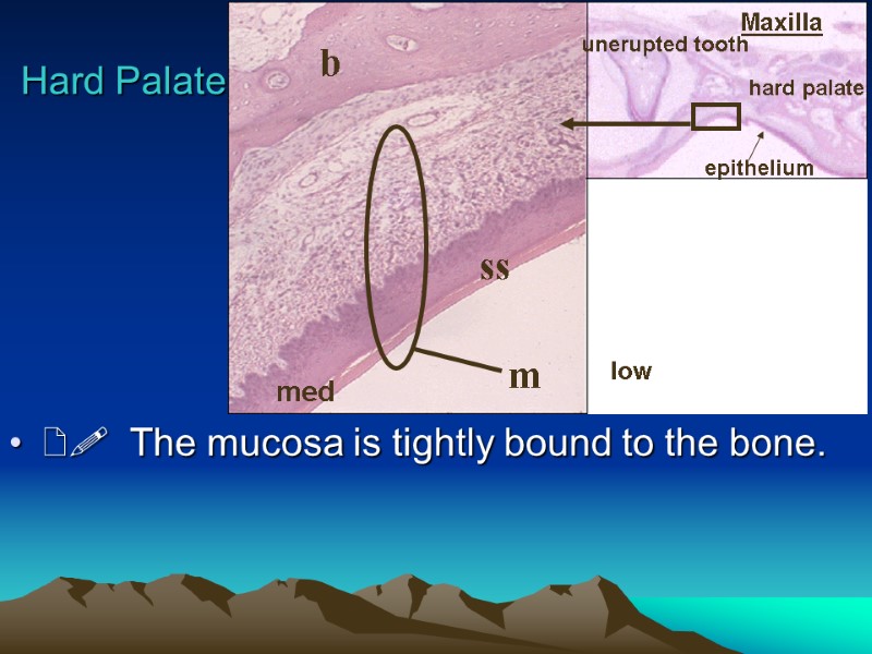   The mucosa is tightly bound to the bone. Hard Palate Maxilla unerupted